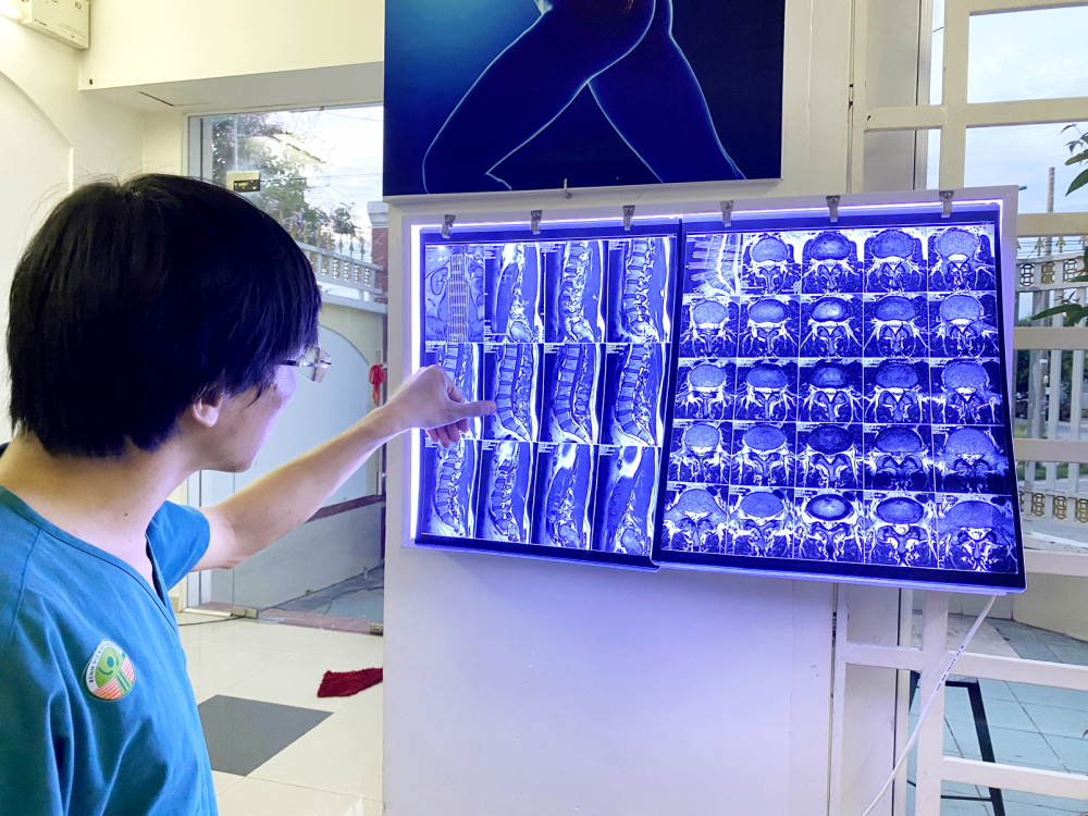 Làm sao tránh cong vẹo cột sống ở tuổi học đường?